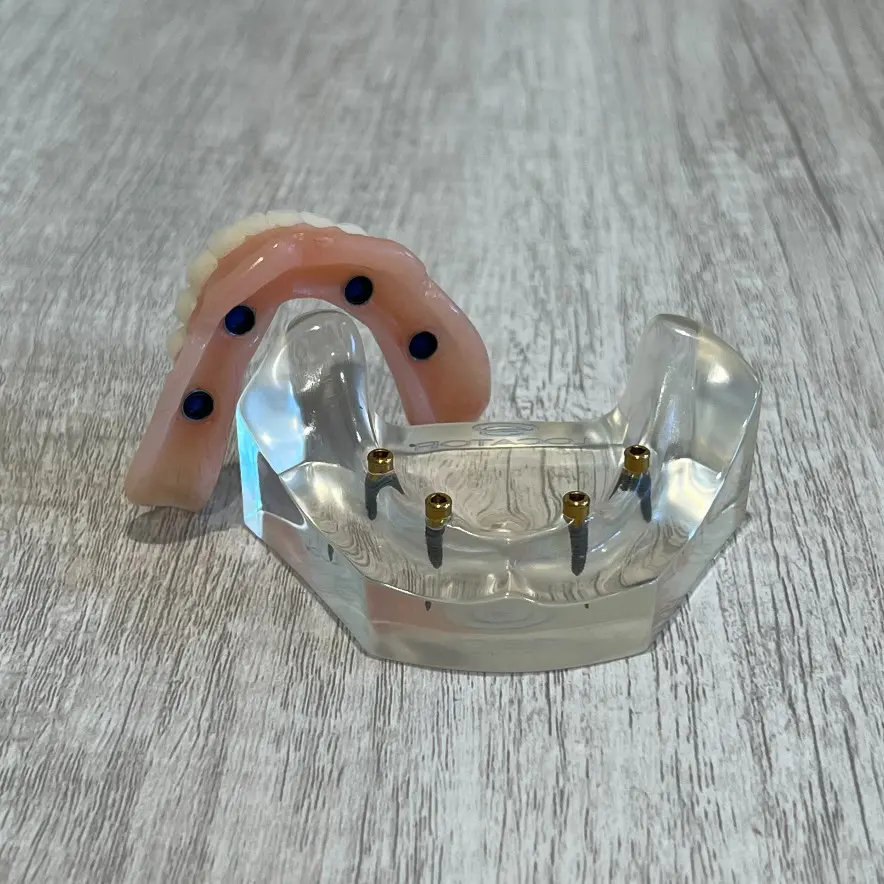 snap-in implant dentures Nashville, TN